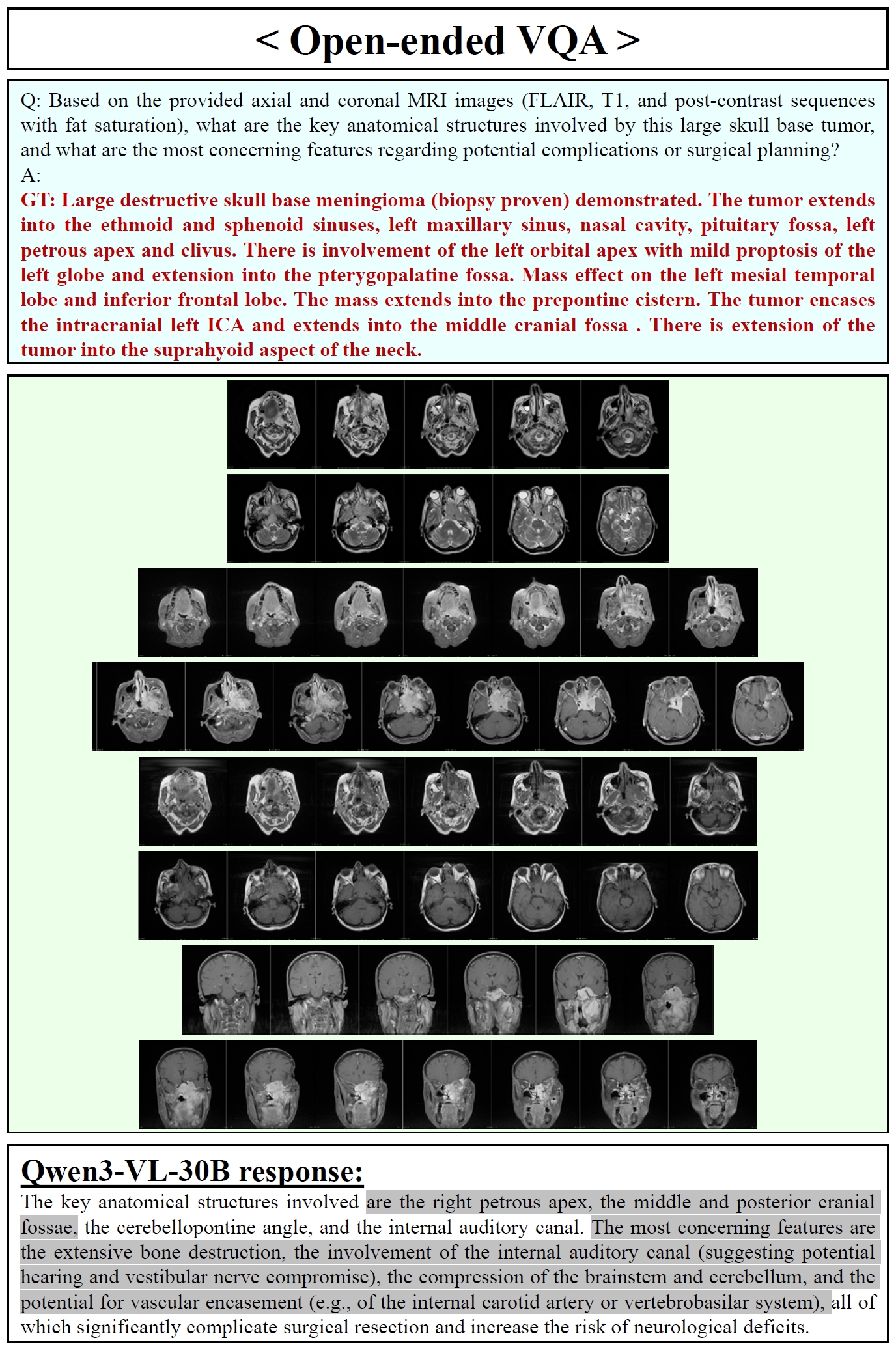 Qwen3-VL-30B Open-ended VQA Samples